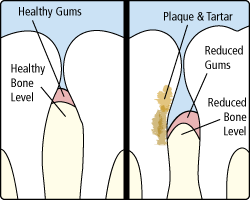 Healthy gum diagram